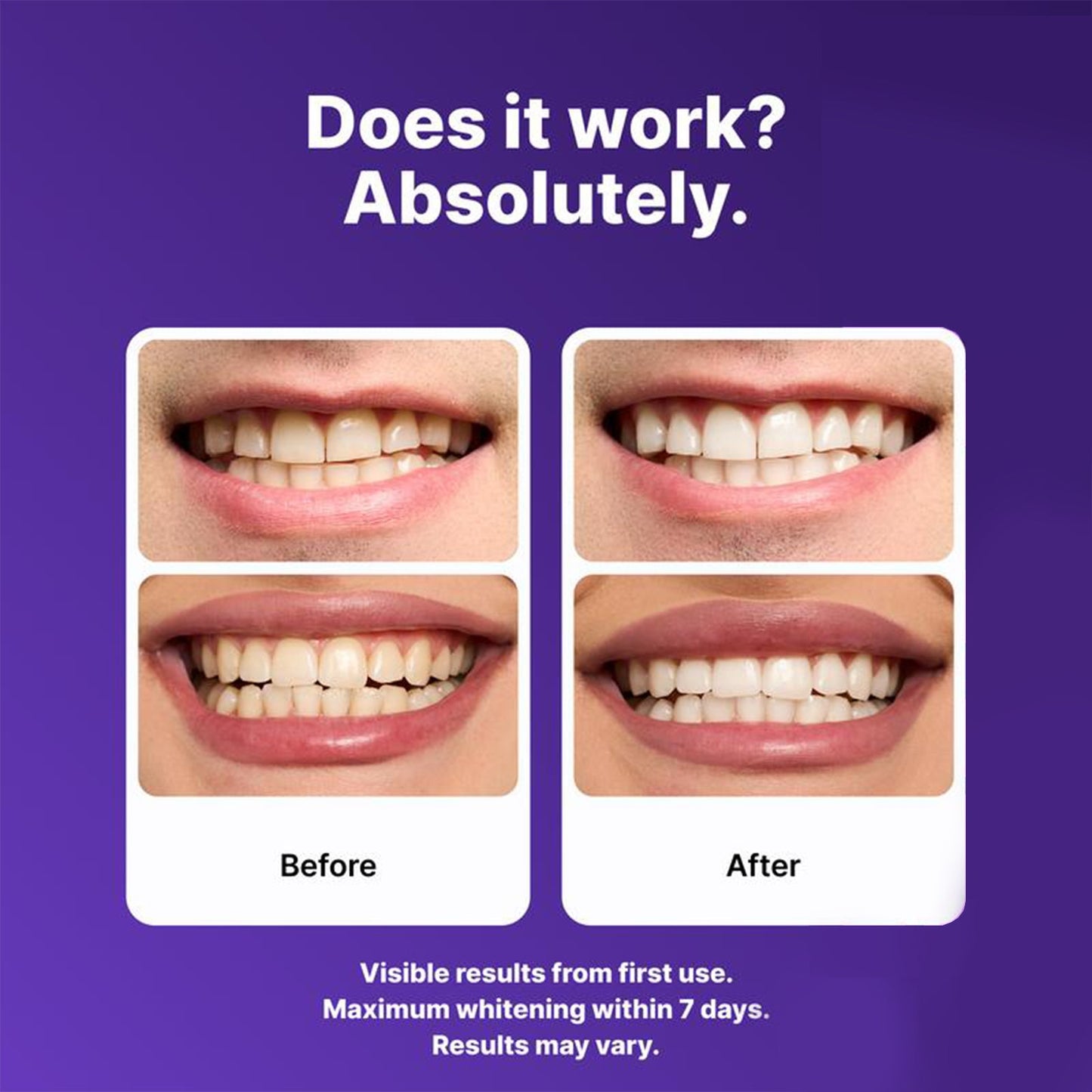Purple Teeth Whitening